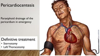 Paraxiphoid Chest Trauma MBBS teaching in Lilongwe Malawi | PDF