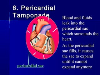 6. Pericardial6. Pericardial
TamponadeTamponade Blood and fluidsBlood and fluids
leak into theleak into the
pericardial sacpericardial sac
which surrounds thewhich surrounds the
heart.heart.
As the pericardialAs the pericardial
sac fills, it causessac fills, it causes
the sac to expandthe sac to expand
until it cannotuntil it cannot
expand anymoreexpand anymorepericardial sac
 