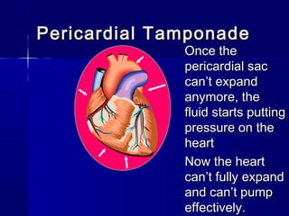Pericardial TamponadePericardial Tamponade
Once theOnce the
pericardial sacpericardial sac
can’t expandcan’t expand
anymore, theanymore, the
fluid starts puttingfluid starts putting
pressure on thepressure on the
heartheart
Now the heartNow the heart
can’t fully expandcan’t fully expand
and can’t pumpand can’t pump
effectively.effectively.
 