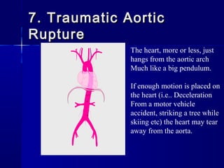 7. Traumatic Aortic7. Traumatic Aortic
RuptureRupture
The heart, more or less, just
hangs from the aortic arch
Much like a big pendulum.
If enough motion is placed on
the heart (i.e.. Deceleration
From a motor vehicle
accident, striking a tree while
skiing etc) the heart may tear
away from the aorta.
 