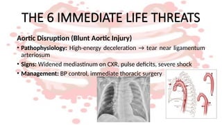 Comprehensive Chest Trauma Management: Assessment and Life-saving ...