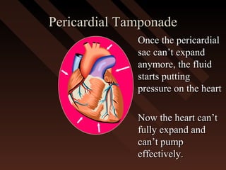 Pericardial TamponadePericardial Tamponade
Once the pericardialOnce the pericardial
sac can’t expandsac can’t expand
anymore, the fluidanymore, the fluid
starts puttingstarts putting
pressure on the heartpressure on the heart
Now the heart can’tNow the heart can’t
fully expand andfully expand and
can’t pumpcan’t pump
effectively.effectively.
 
