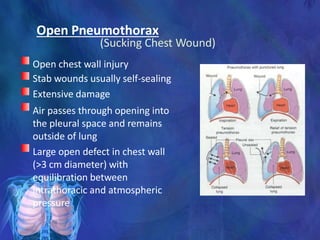 Open Pneumothorax
(Sucking Chest Wound)
Open chest wall injury
Stab wounds usually self-sealing
Extensive damage
Air passes through opening into
the pleural space and remains
outside of lung
Large open defect in chest wall
(>3 cm diameter) with
equilibration between
intrathoracic and atmospheric
pressure
 
