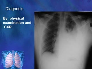 Diagnosis
By physical
examination and
CXR
 