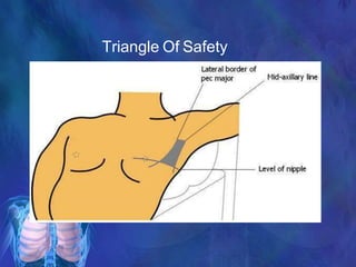 Triangle Of Safety
 