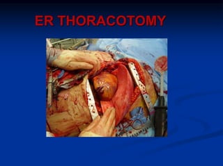 ER THORACOTOMY
 