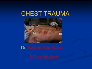 CHEST TRAUMA
Dr: Kamal Abu Alrish
ER consultant
 