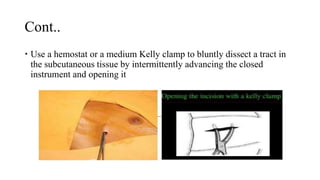 Cont..
 Use a hemostat or a medium Kelly clamp to bluntly dissect a tract in
the subcutaneous tissue by intermittently advancing the closed
instrument and opening it
 