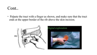 Cont..
 Palpate the tract with a finger as shown, and make sure that the tract
ends at the upper border of the rib above the skin incision.
 