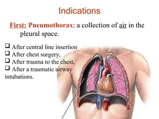 Indications
First: Pneumothorax: a collection of air in the
pleural space.
 After central line insertion
 After chest surgery,
 After trauma to the chest,
 After a traumatic airway
intubations.
 