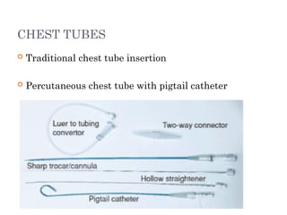chest tube insertion challenges in neonates | PPTX
