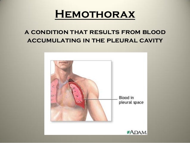 Chest Tube Care Copy