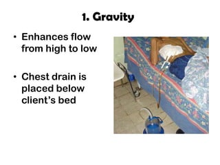 1. Gravity
• Enhances flow
from high to low
• Chest drain is
placed below
client’s bed
 