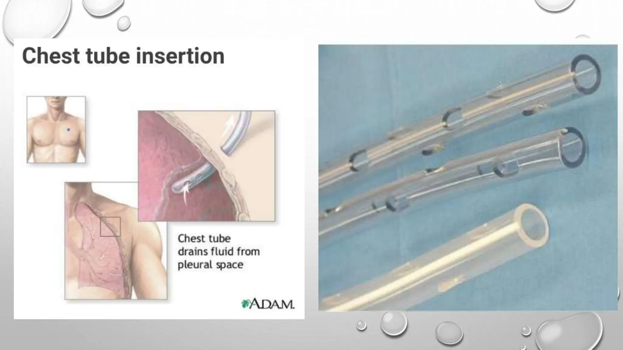 Chest tube insertion care important to me | PPTX