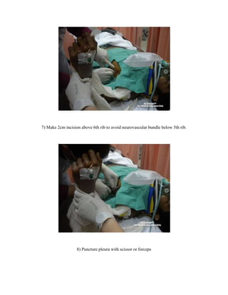 Post operative procedure.Preparation<br />Trolley with dressing pack, chest tube set and suture set.