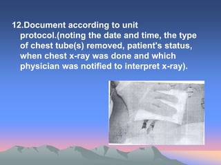 12.Document according to unit
protocol.(noting the date and time, the type
of chest tube(s) removed, patient's status,
when chest x-ray was done and which
physician was notified to interpret x-ray).
 