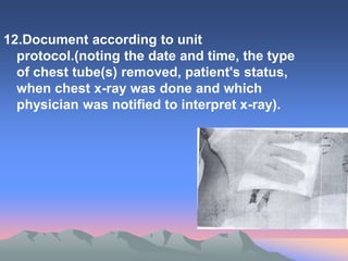 12.Document according to unit
protocol.(noting the date and time, the type
of chest tube(s) removed, patient's status,
when chest x-ray was done and which
physician was notified to interpret x-ray).
 