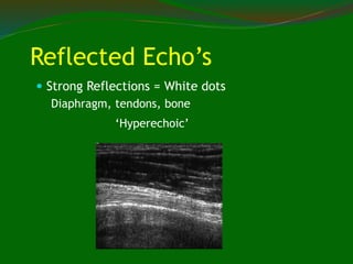 Reflected Echo’s
 Strong Reflections = White dots
Diaphragm, tendons, bone
‘Hyperechoic’
 