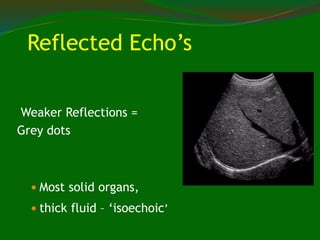 Weaker Reflections =
Grey dots
 Most solid organs,
 thick fluid – ‘isoechoic’
Reflected Echo’s
 