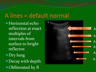 A lines = default normal
 Horizontal echo
reflection at exact
multiples of
intervals from
surface to bright
reflector.
 Dry lung
 Decay with depth
 Obliterated by B
pleura A
A
A
A
A
A
 
