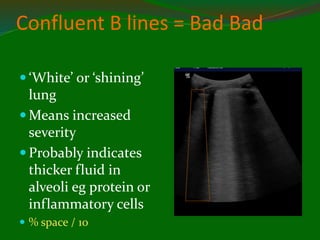 Confluent B lines = Bad Bad
 ‘White’ or ‘shining’
lung
 Means increased
severity
 Probably indicates
thicker fluid in
alveoli eg protein or
inflammatory cells
 % space / 10
 