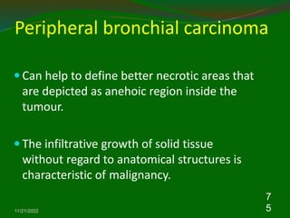 Peripheral bronchial carcinoma
 Can help to define better necrotic areas that
are depicted as anehoic region inside the
tumour.
 The infiltrative growth of solid tissue
without regard to anatomical structures is
characteristic of malignancy.
11/21/2022
7
5
 
