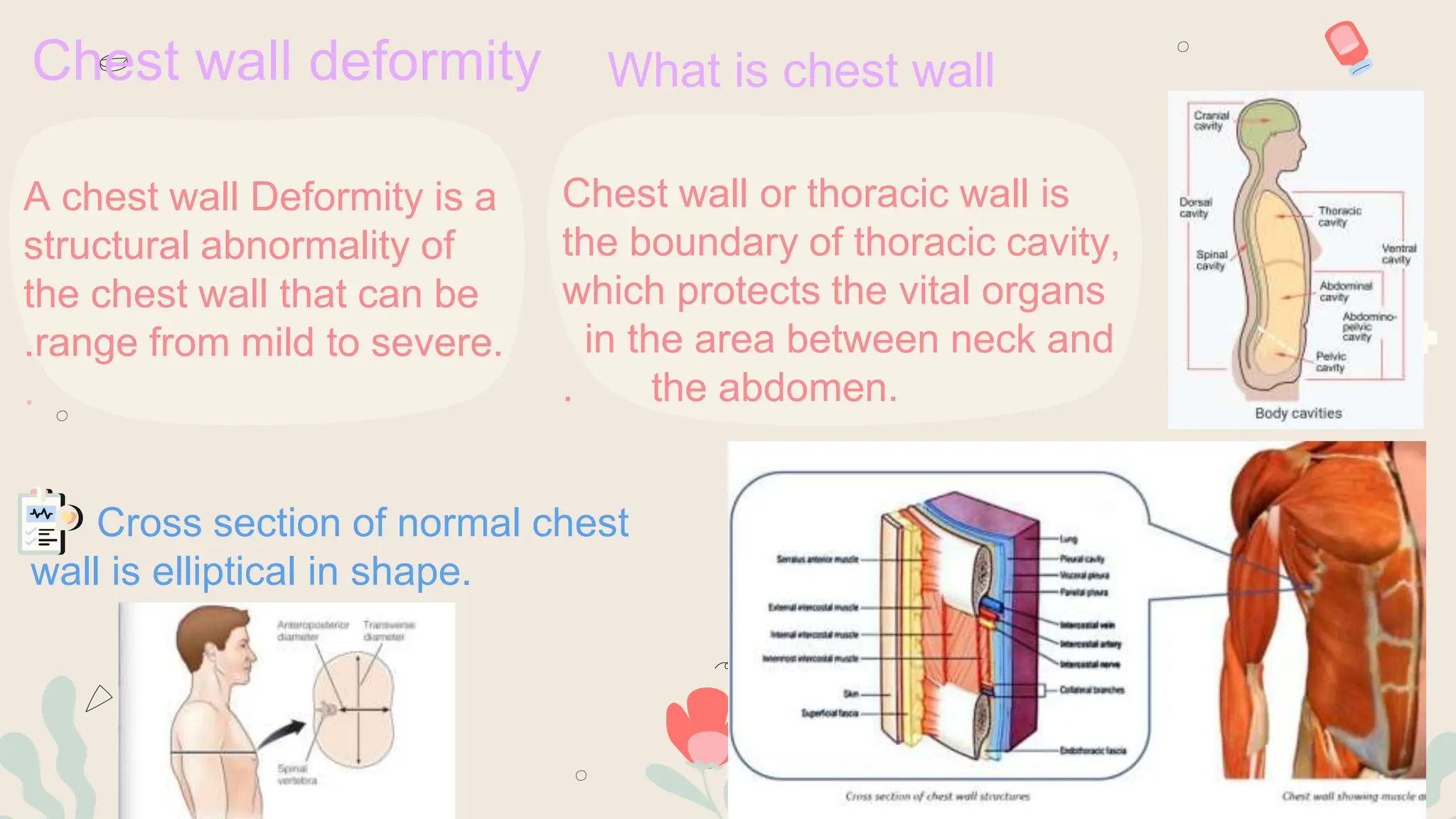 chest wall deformities ( pectus excavatum, pectus carinatum etc.) PPT