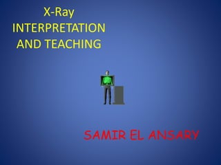 X-Ray
INTERPRETATION
AND TEACHING
SAMIR EL ANSARY
 