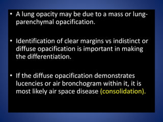 Chest x. ray interpretation and teaching | PPTX