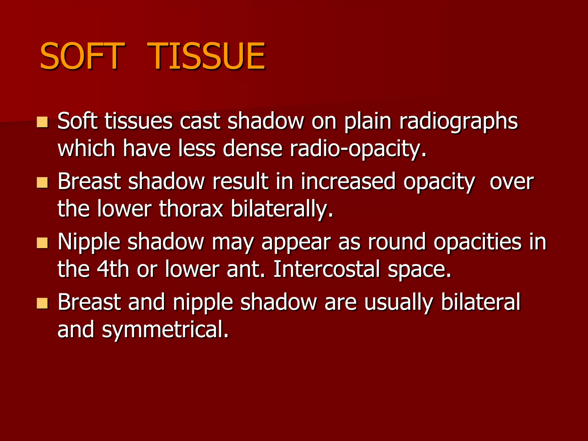 Chest x ray | PPT