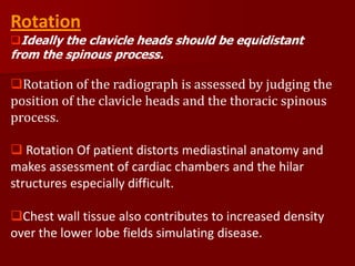 Rotation

Ideally the clavicle heads should be equidistant

from the spinous process.

Rotation of the radiograph is assessed by judging the
position of the clavicle heads and the thoracic spinous
process.
 Rotation Of patient distorts mediastinal anatomy and
makes assessment of cardiac chambers and the hilar
structures especially difficult.
Chest wall tissue also contributes to increased density
over the lower lobe fields simulating disease.

 