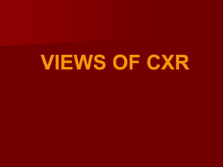 VIEWS OF CXR

 