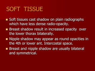 SOFT TISSUE
Soft tissues cast shadow on plain radiographs
which have less dense radio-opacity.
 Breast shadow result in increased opacity over
the lower thorax bilaterally.
 Nipple shadow may appear as round opacities in
the 4th or lower ant. Intercostal space.
 Breast and nipple shadow are usually bilateral
and symmetrical.


 