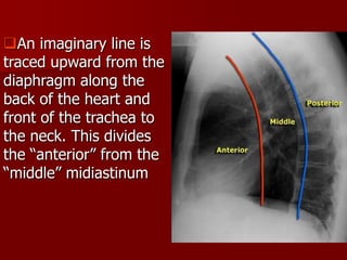 An imaginary line is
traced upward from the
diaphragm along the
back of the heart and
front of the trachea to
the neck. This divides
the “anterior” from the
“middle” midiastinum

 