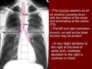 The trachea appears as an
air-shadow coursing down
(c6) the midline of the chest
and terminating at the carina
(T5).
The left and right mainstem
bronchi, as well as the lobar
bronchi may be evident
A very slight deviation to
the right at the level of
aortic arch, moderate
deviation to the right is
common in infant.

 