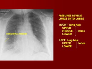 FISSURES DIVIDE
LUNGS INTO LOBES

HORIZONTAL FISSURE

RIGHT lung has:
UPPER
MIDDLE
lobes
LOWER
LEFT lung has:
UPPER
lobes
LOWER

 