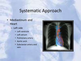 Systematic Approach
• Mediastinum and
Heart
– Left side
• Left ventricle
• Left atrium
• Pulmonary artery
• Aortic arch
• Subclavian artery and
vein
 
