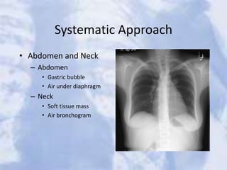 Systematic Approach
• Abdomen and Neck
– Abdomen
• Gastric bubble
• Air under diaphragm
– Neck
• Soft tissue mass
• Air bronchogram
 