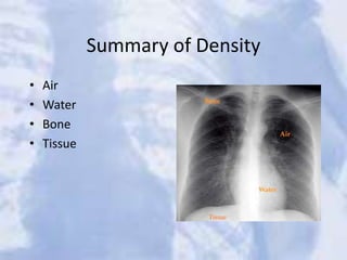 Summary of Density
• Air
• Water
• Bone
• Tissue
Tissue
 