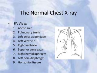 The Normal Chest X-ray
• PA View:
1. Aortic arch
2. Pulmonary trunk
3. Left atrial appendage
4. Left ventricle
5. Right ventricle
6. Superior vena cava
7. Right hemidiaphragm
8. Left hemidiaphragm
9. Horizontal fissure
 