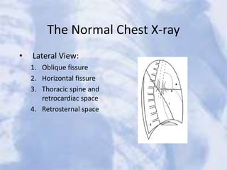 The Normal Chest X-ray
• Lateral View:
1. Oblique fissure
2. Horizontal fissure
3. Thoracic spine and
retrocardiac space
4. Retrosternal space
 