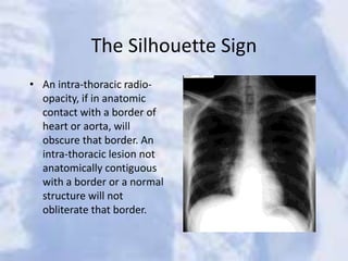 The Silhouette Sign
• An intra-thoracic radio-
opacity, if in anatomic
contact with a border of
heart or aorta, will
obscure that border. An
intra-thoracic lesion not
anatomically contiguous
with a border or a normal
structure will not
obliterate that border.
 
