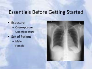 Essentials Before Getting Started
• Exposure
– Overexposure
– Underexposure
• Sex of Patient
– Male
– Female
 