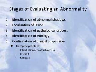 Stages of Evaluating an Abnormality
1. Identification of abnormal shadows
2. Localization of lesion
3. Identification of pathological process
4. Identification of etiology
5. Confirmation of clinical suspension
 Complex problems
• Introduction of contrast medium
• CT chest
• MRI scan
 