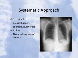 Systematic Approach
• Soft Tissues
– Breast shadows
– Supraclavicular areas
– Axillae
– Tissues along side of
breasts
 
