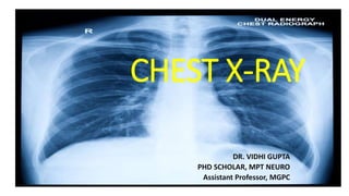 CHEST X-RAY
DR. VIDHI GUPTA
PHD SCHOLAR, MPT NEURO
Assistant Professor, MGPC
 