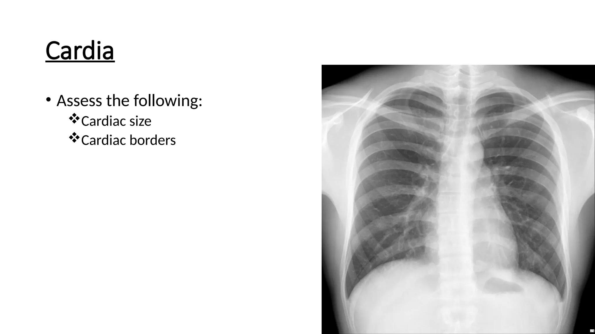 Cardia
• Assess the following:
Cardiac size
Cardiac borders
 