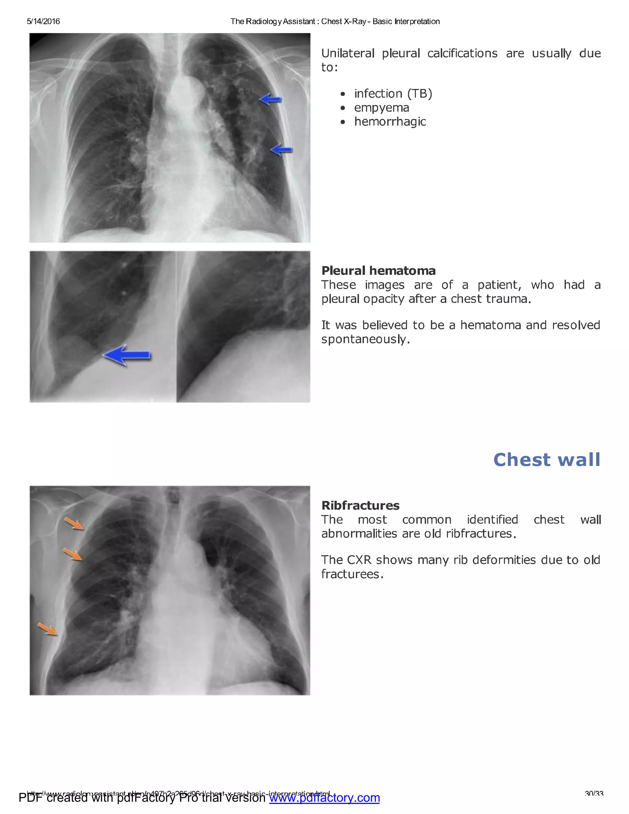 Chest x ray - basic interpretation | PDF