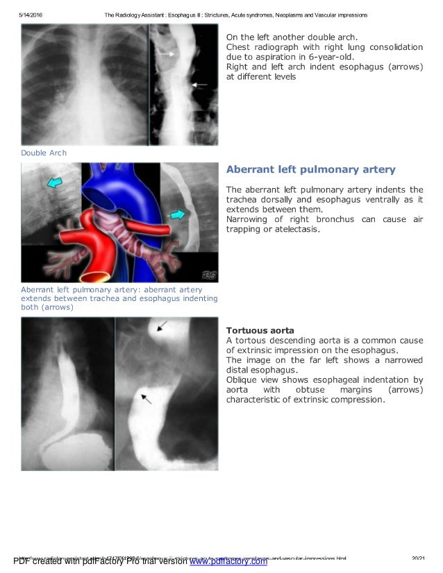 Chest x ray esophagus part ii
