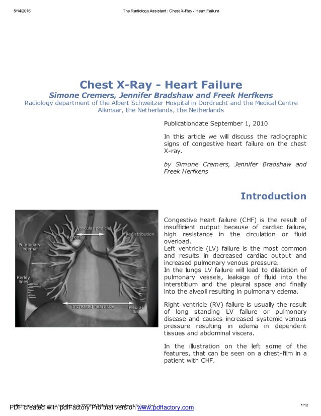 Chest x ray heart failure